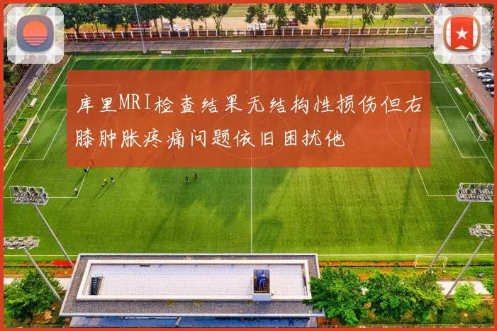 库里MRI检查结果无结构性损伤但右膝肿胀疼痛问题依旧困扰他